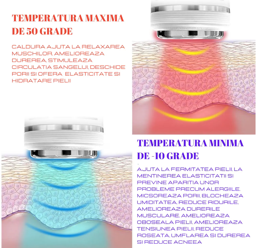 Infografic tehnic in limba romana ce explica actiunea temperaturii si a undelor de radiofrecventa asupra straturilor pielii.